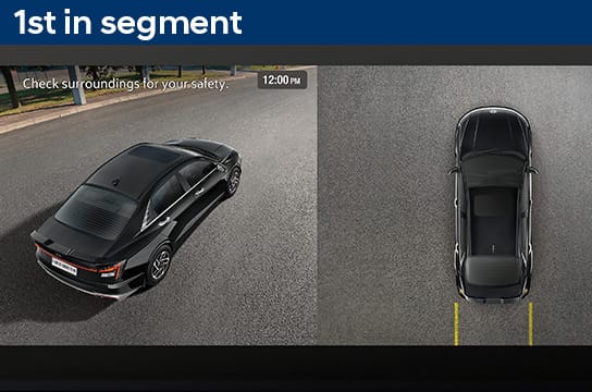 surround view monitor